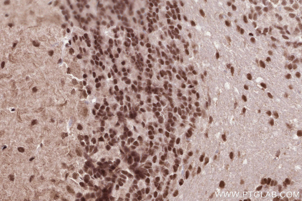 Immunohistochemical analysis of paraffin-embedded rat cerebellum tissue slide using KHC2584 (ZCCHC8 IHC Kit).