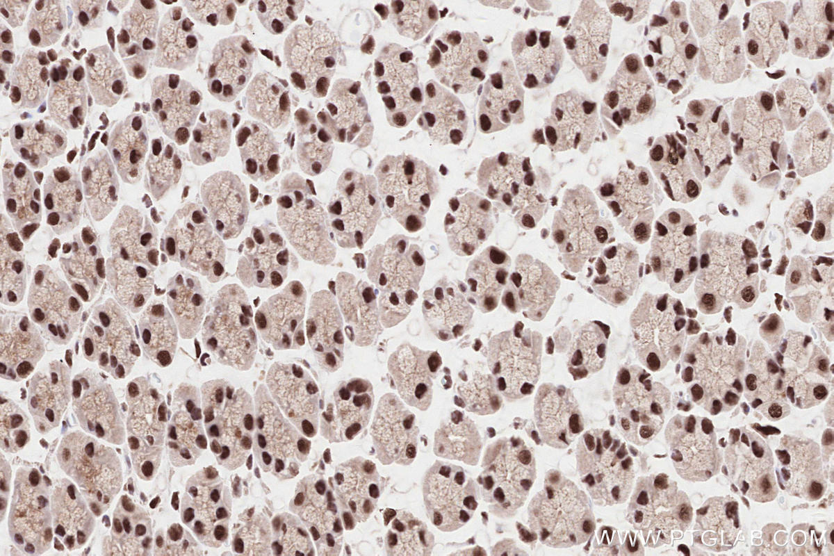 Immunohistochemical analysis of paraffin-embedded rat stomach tissue slide using KHC2584 (ZCCHC8 IHC Kit).