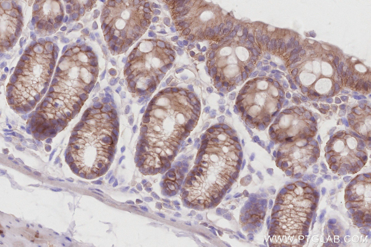 Immunohistochemical analysis of paraffin-embedded mouse colon tissue slide using KHC2891 (ZDHHC5 IHC Kit).