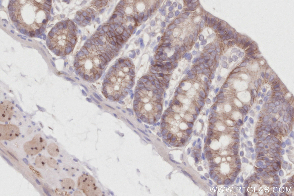Immunohistochemical analysis of paraffin-embedded rat colon tissue slide using KHC2891 (ZDHHC5 IHC Kit).