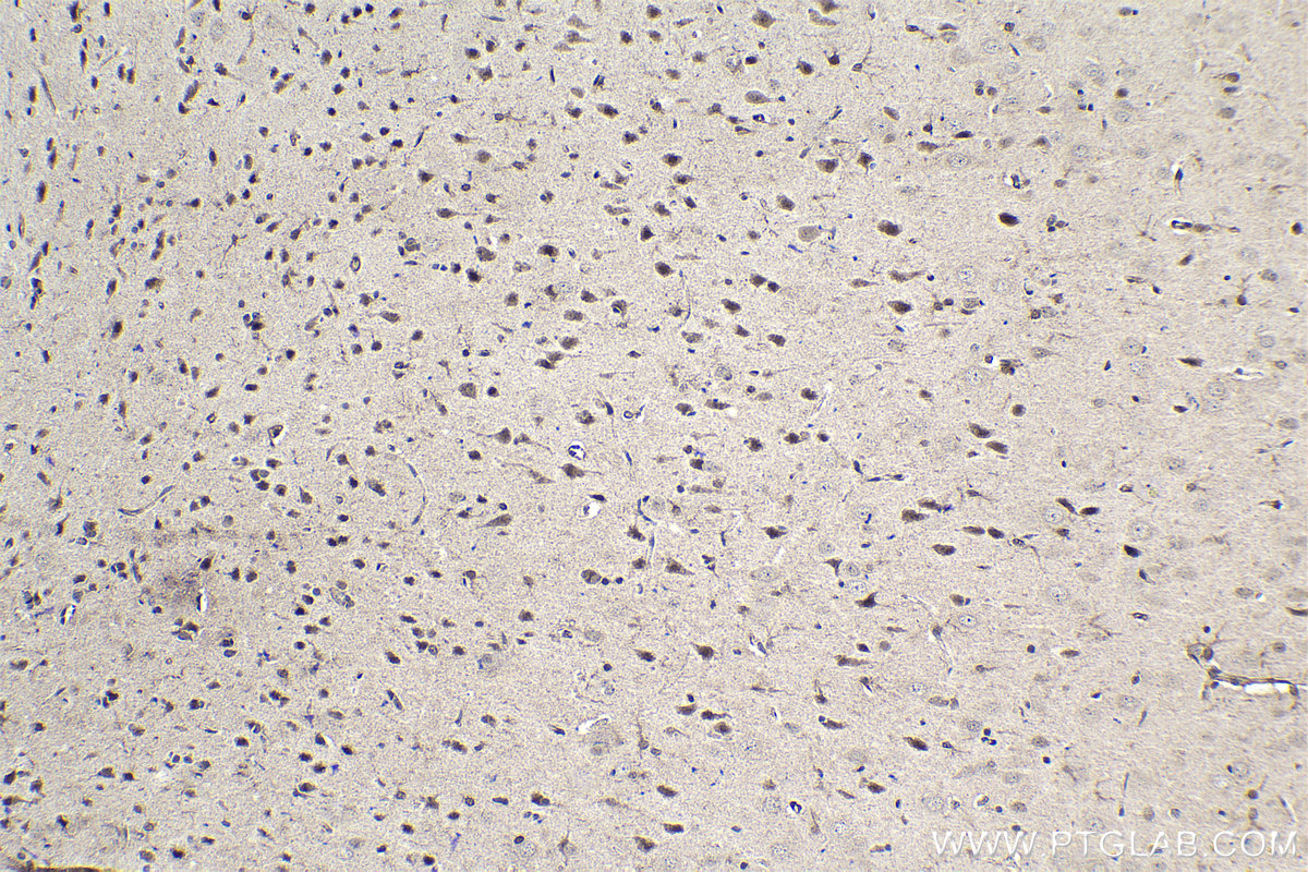 Immunohistochemical analysis of paraffin-embedded rat brain tissue slide using KHC1567 (ZFP36 IHC Kit).