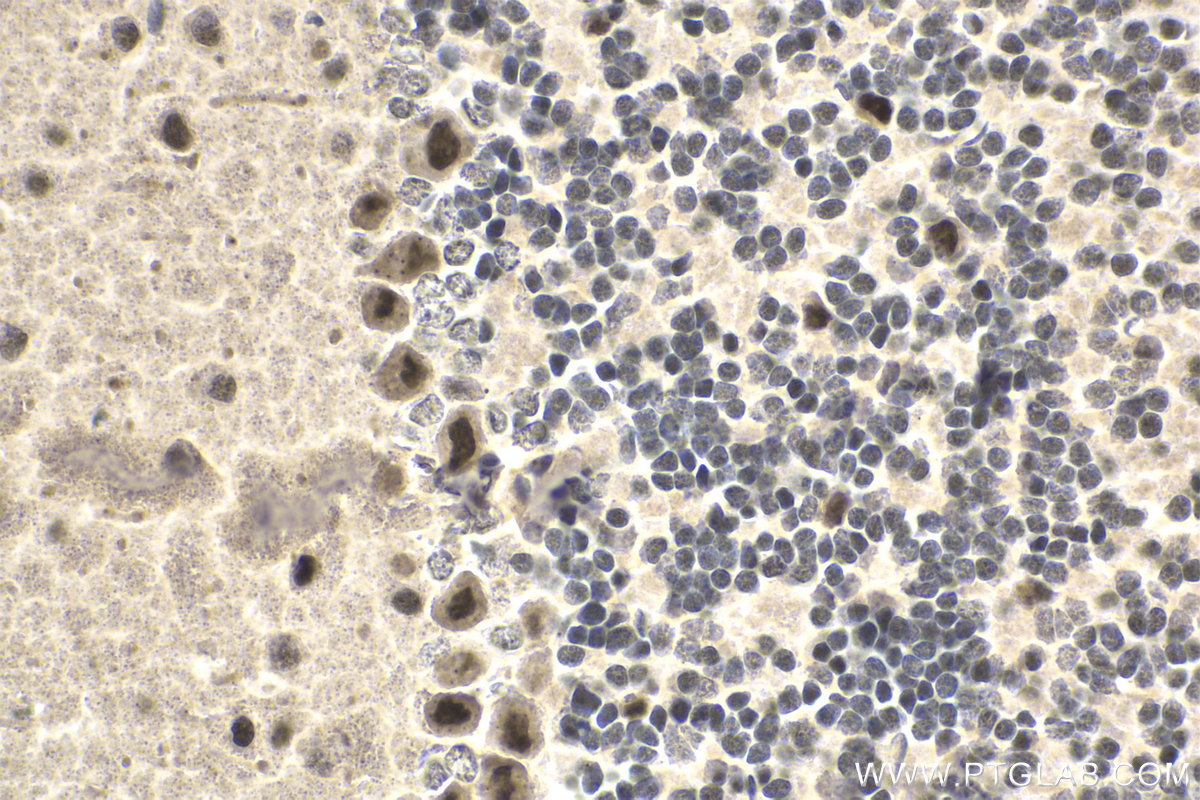 Immunohistochemical analysis of paraffin-embedded mouse cerebellum tissue slide using KHC1819 (ZFPM1 IHC Kit).