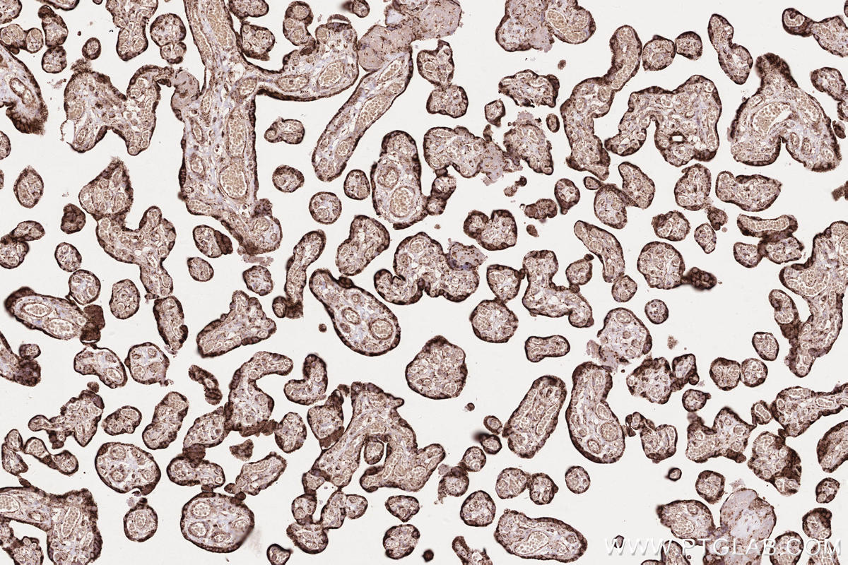 Immunohistochemical analysis of paraffin-embedded human placenta tissue slide using KHC2572 (ZFYVE26 IHC Kit).
