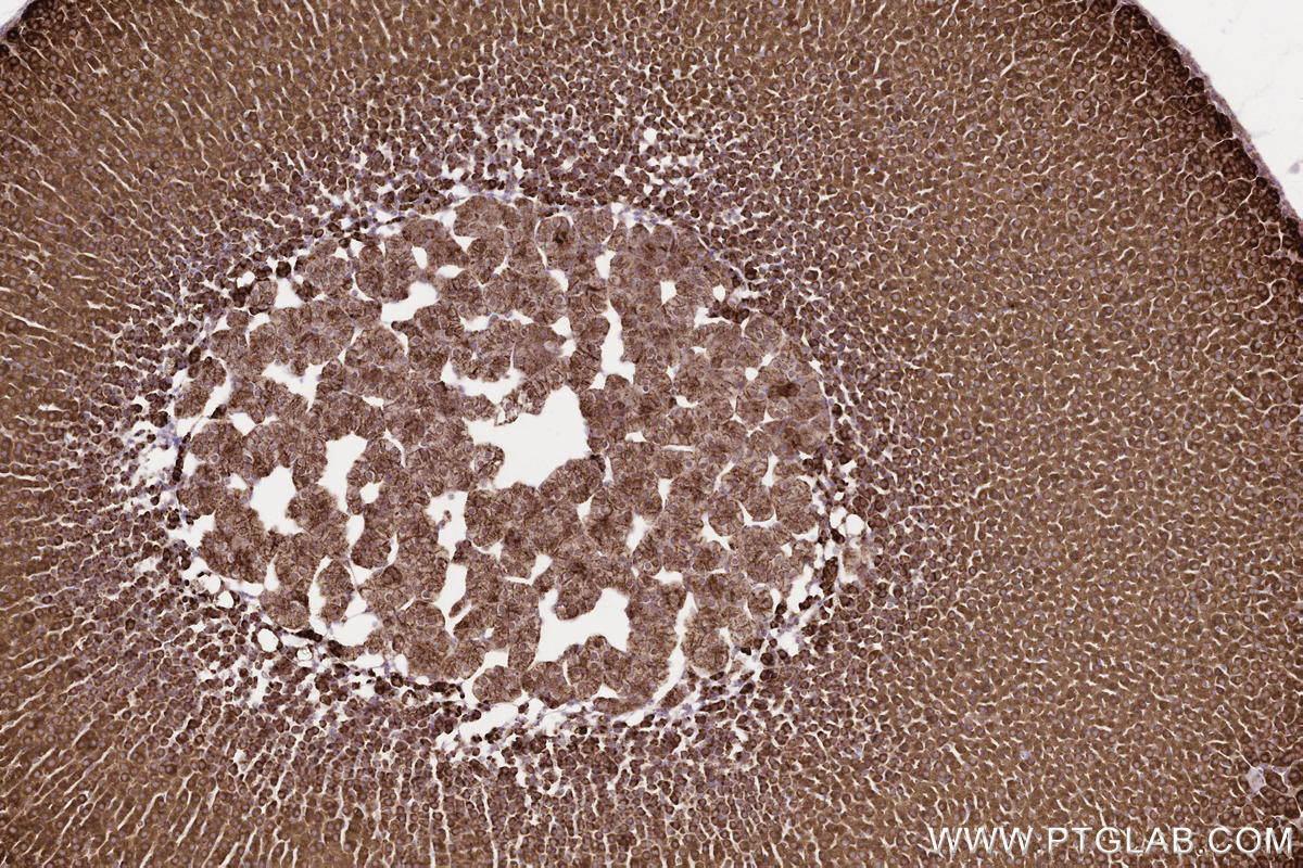 Immunohistochemical analysis of paraffin-embedded mouse adrenal gland tissue slide using KHC2572 (ZFYVE26 IHC Kit).