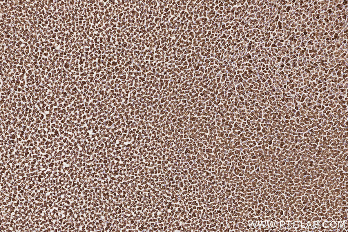 Immunohistochemical analysis of paraffin-embedded rat adrenal gland tissue slide using KHC2572 (ZFYVE26 IHC Kit).