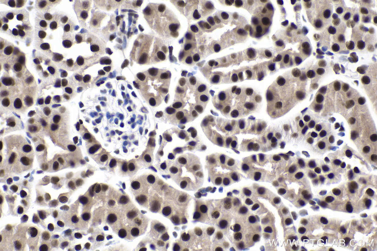 Immunohistochemical analysis of paraffin-embedded mouse kidney tissue slide using KHC1932 (ZHX3 IHC Kit).