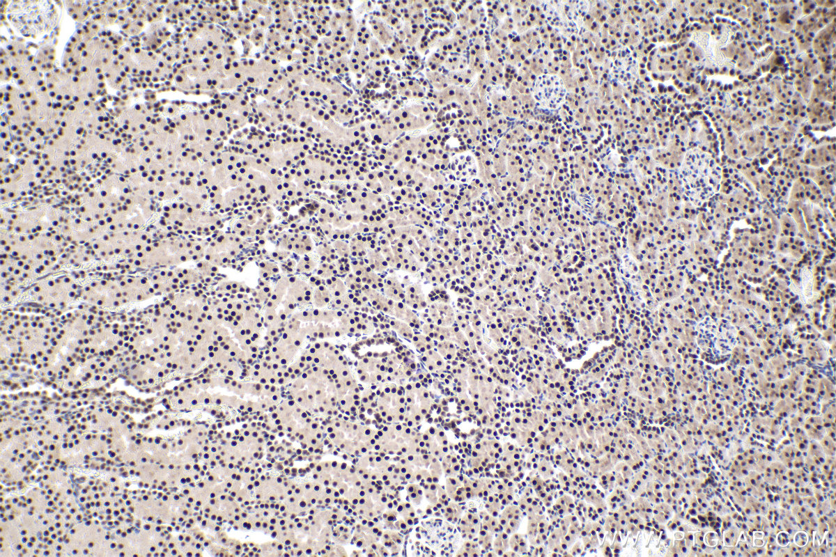 Immunohistochemical analysis of paraffin-embedded rat kidney tissue slide using KHC1932 (ZHX3 IHC Kit).