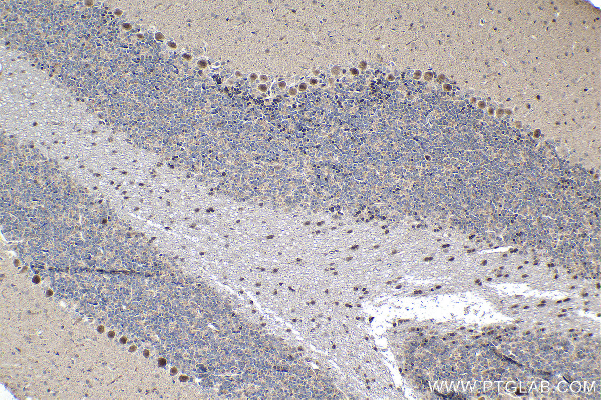 Immunohistochemical analysis of paraffin-embedded rat cerebellum tissue slide using KHC1478 (ZMPSTE24 IHC Kit).