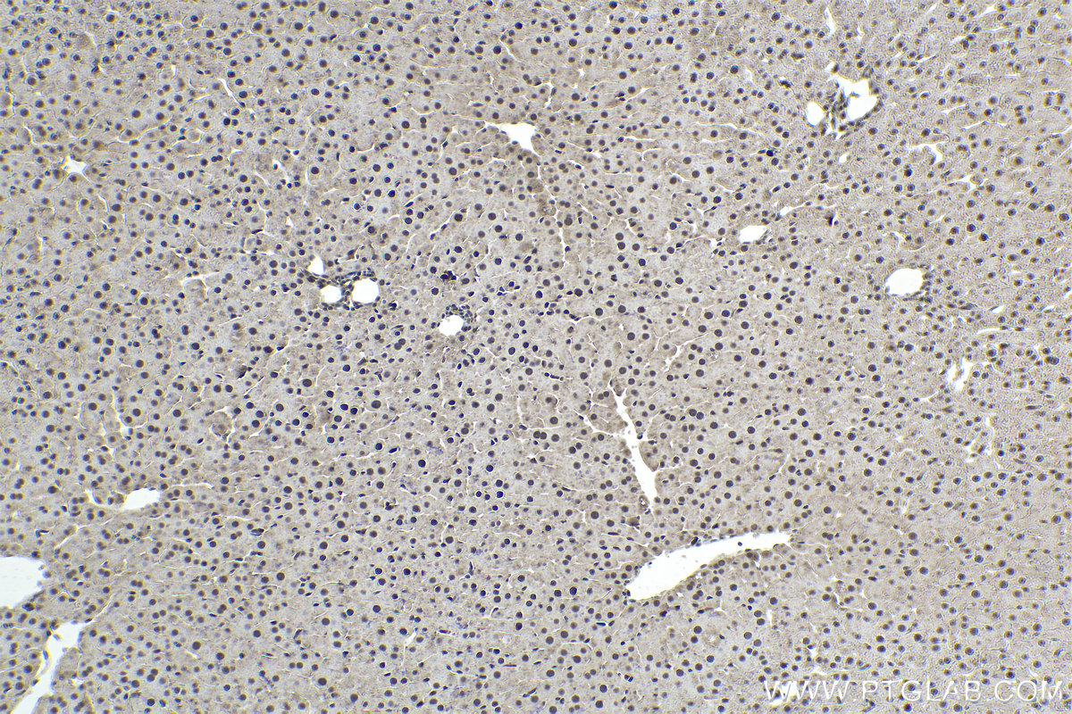 Immunohistochemical analysis of paraffin-embedded rat liver tissue slide using KHC1838 (ZNF397 IHC Kit).