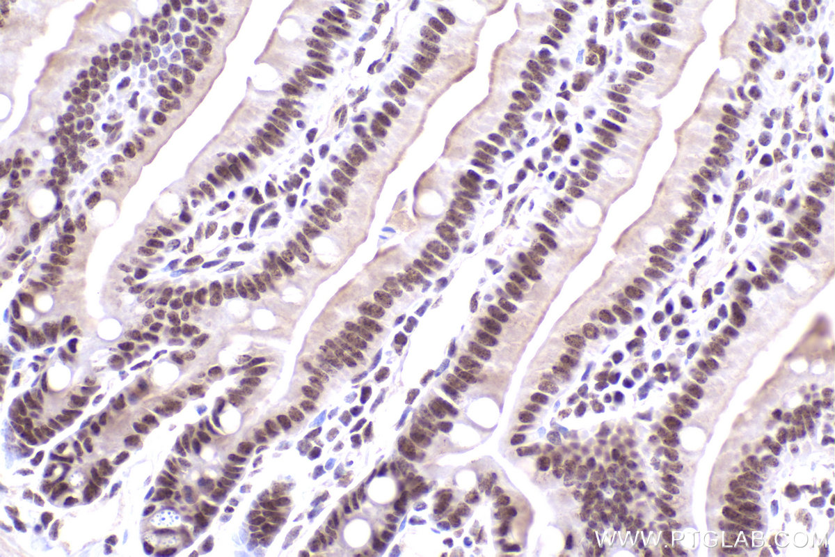 Immunohistochemical analysis of paraffin-embedded mouse small intestine tissue slide using KHC2470 (ZNF638 IHC Kit).