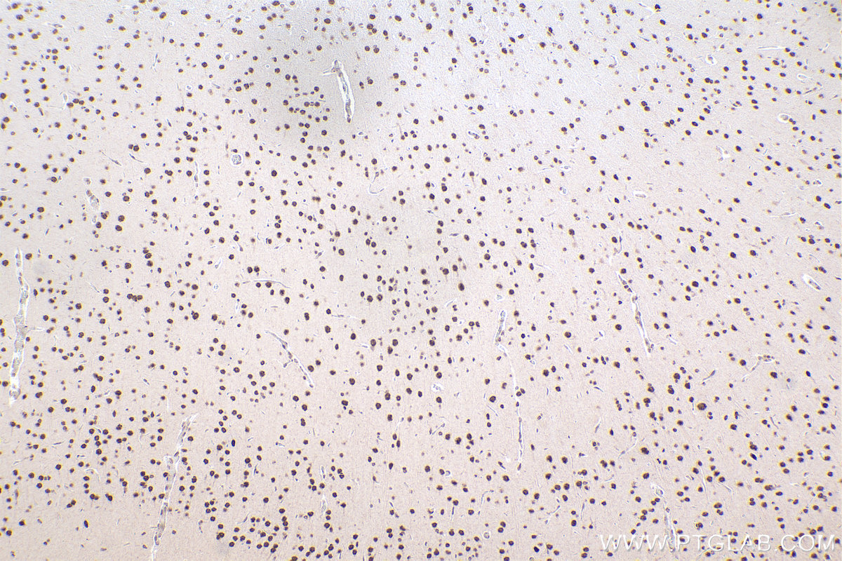 Immunohistochemical analysis of paraffin-embedded rat brain tissue slide using KHC2470 (ZNF638 IHC Kit).