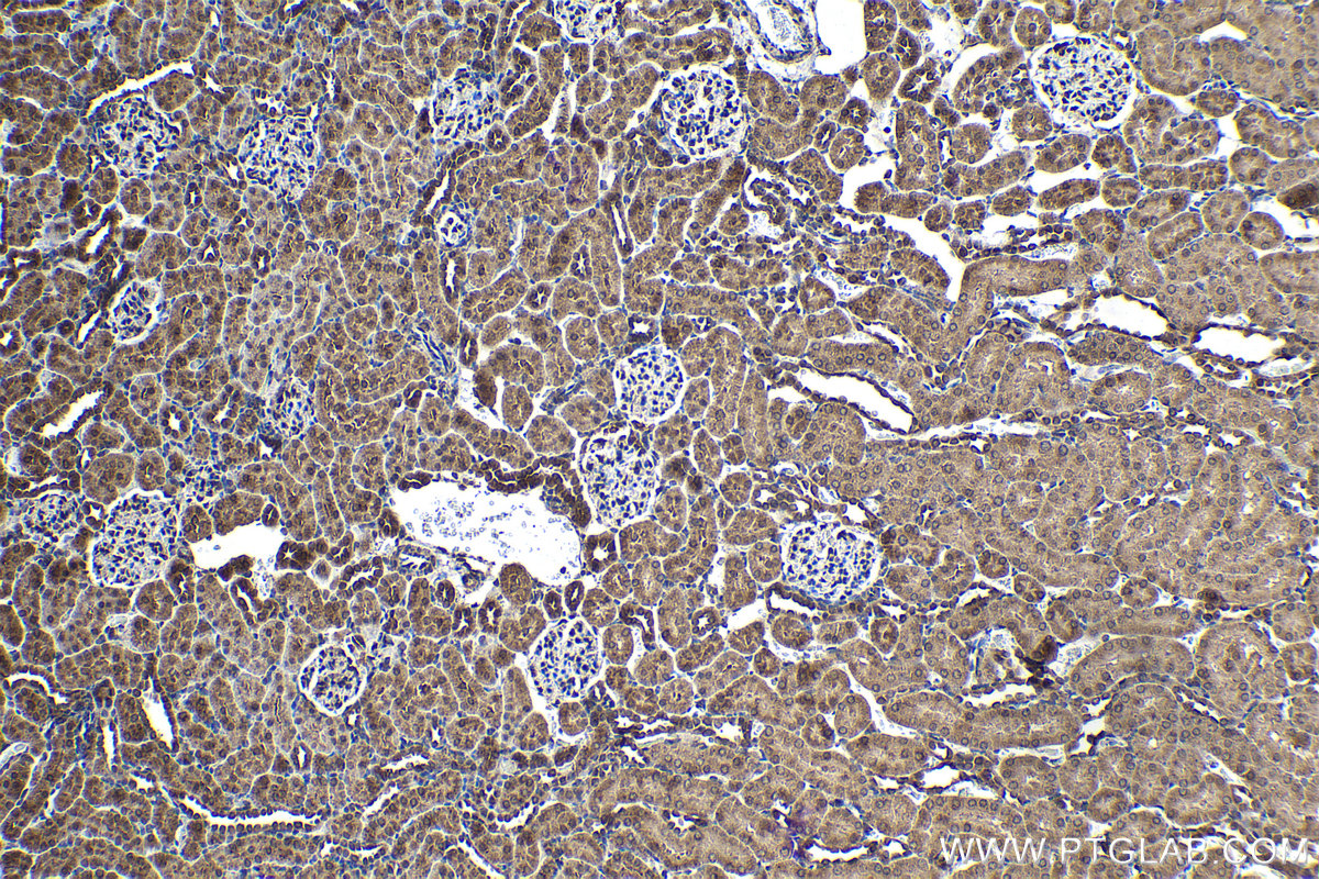 Immunohistochemical analysis of paraffin-embedded rat kidney tissue slide using KHC2078 (ZW10 IHC Kit).