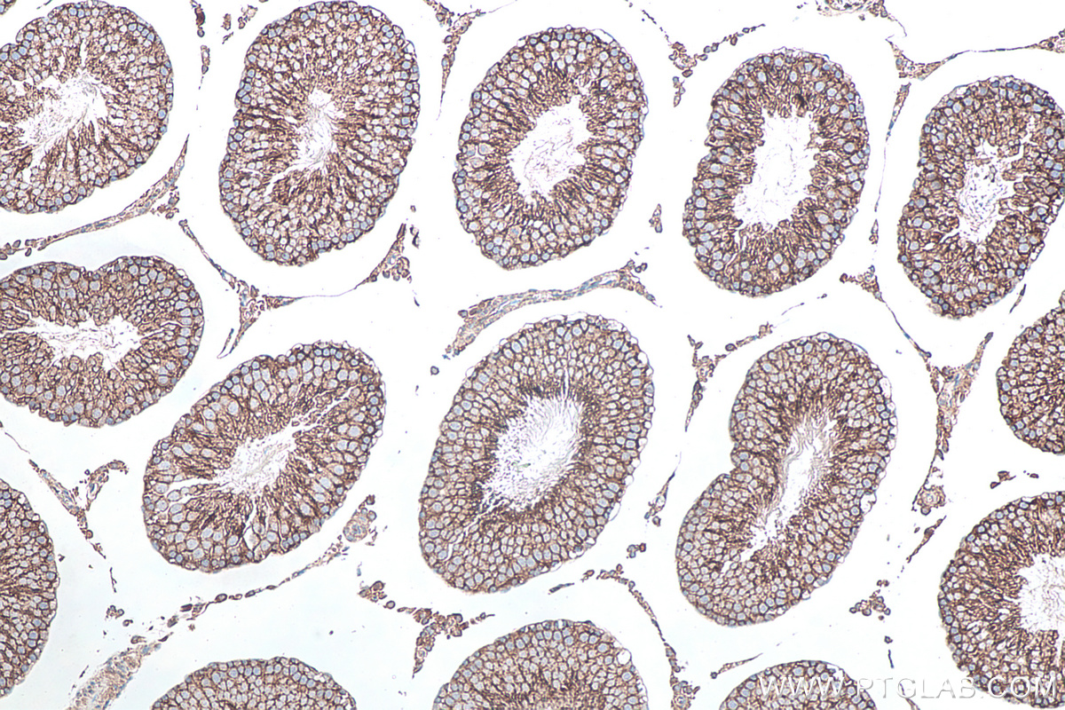 Immunohistochemical analysis of paraffin-embedded rat testis tissue slide using KHC0117 (c-SRC IHC Kit).