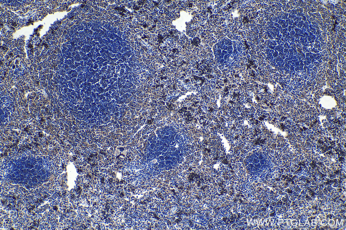 Immunohistochemical analysis of paraffin-embedded mouse spleen tissue slide using KHC1118 (cIAP2/BIRC3 IHC Kit).