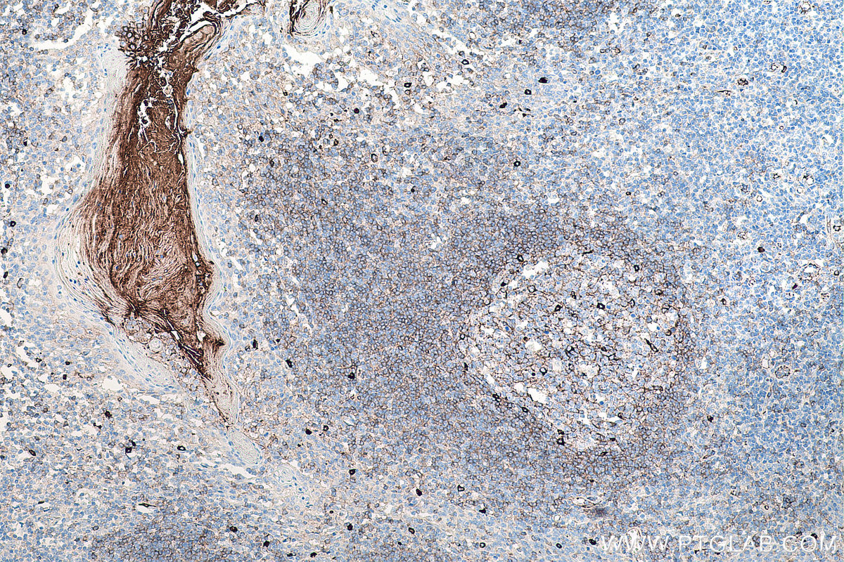 Immunohistochemical analysis of paraffin-embedded human tonsillitis tissue slide using KHC0069 (human IgM IHC Kit).