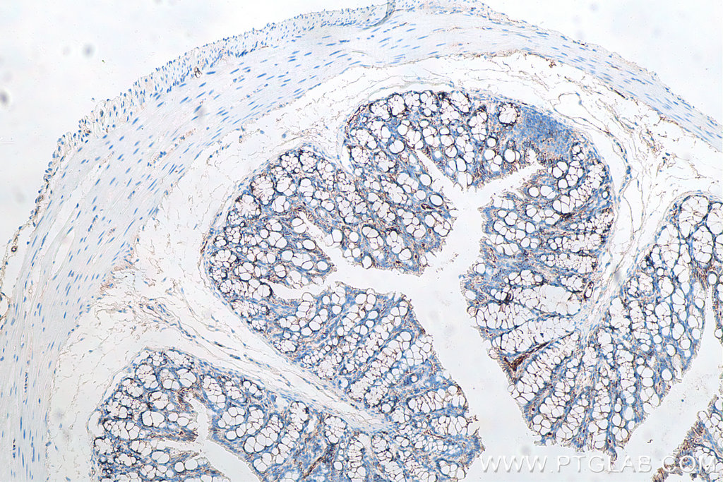 Immunohistochemical analysis of paraffin-embedded mouse colon tissue slide using KHC0009 (p120 Catenin IHC Kit)