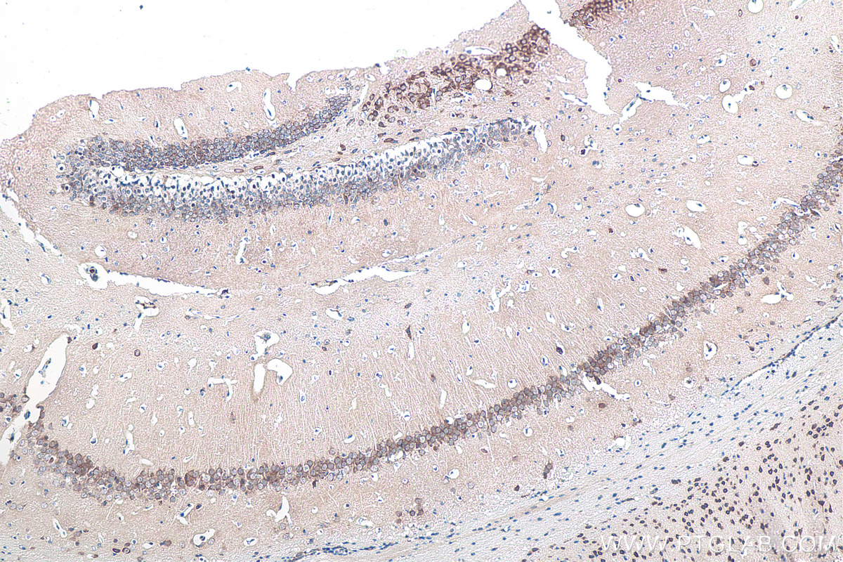 Immunohistochemical analysis of paraffin-embedded mouse brain tissue slide using KHC0118 (p38 MAPK IHC Kit).