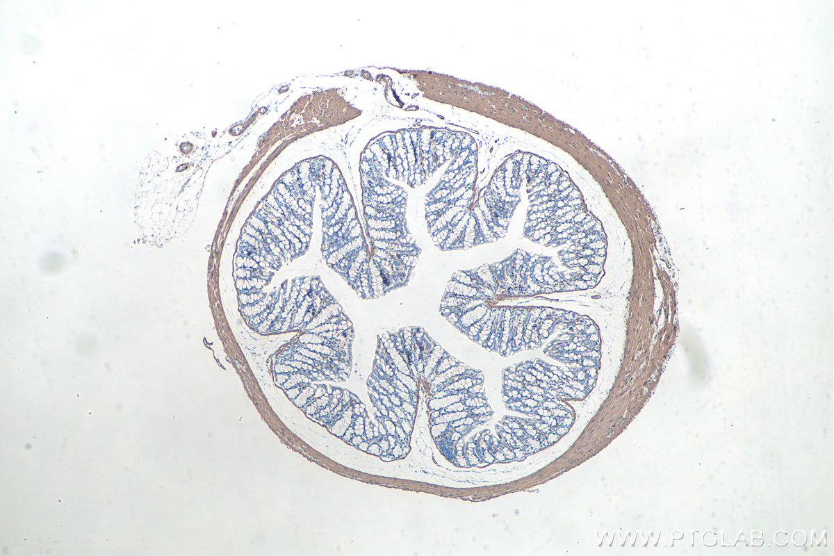 Immunohistochemical analysis of paraffin-embedded mouse colon tissue slide using KHC0053 (smooth muscle actin specific IHC Kit).