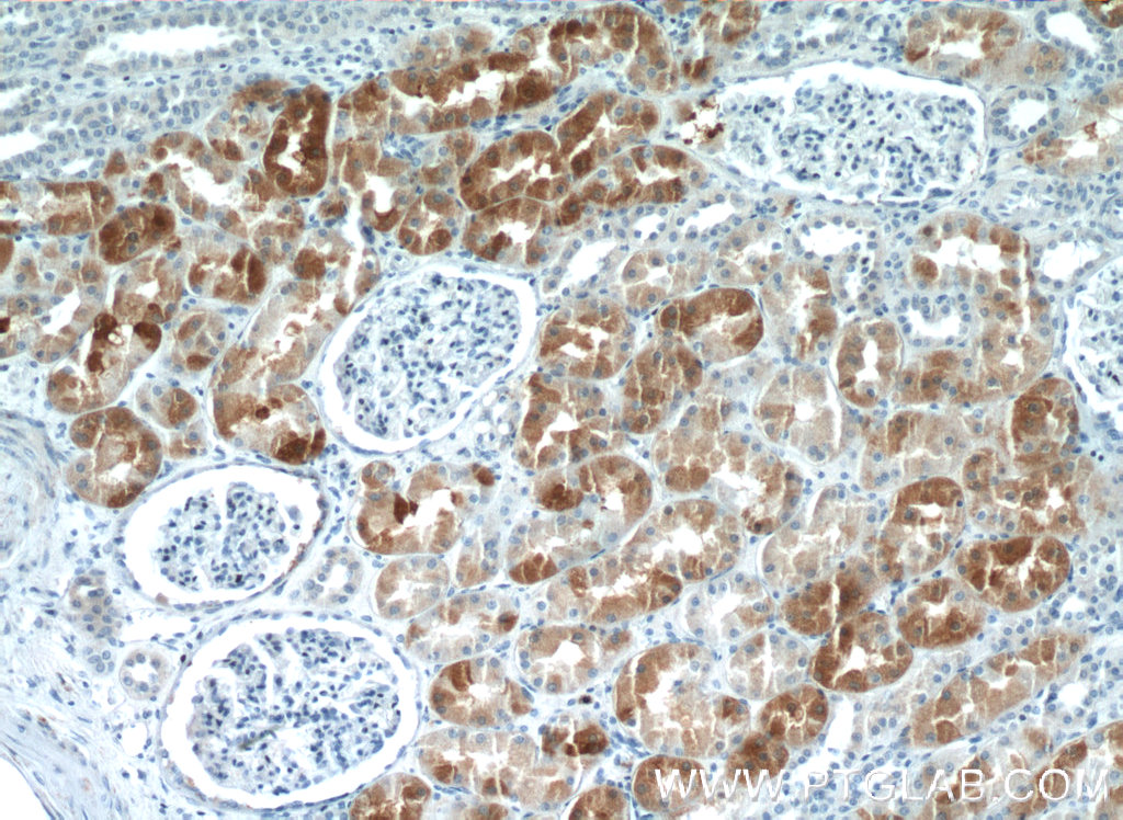 IHC staining of human kidney using 13388-1-AP