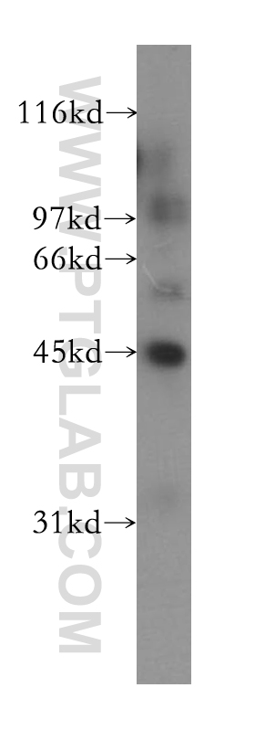 WB analysis of human kidney using 13388-1-AP