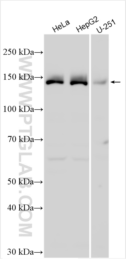 WB analysis using 31705-1-AP