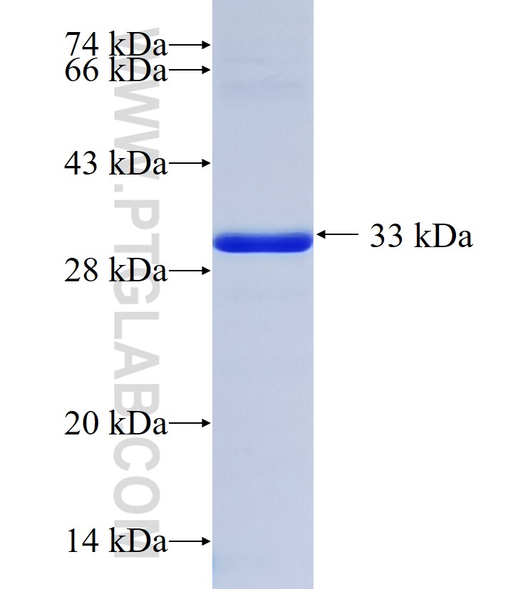 IKBKAP fusion protein Ag35332 SDS-PAGE IKBKAP fusion protein Ag35332 SDS-PAGE