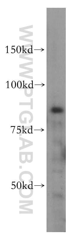 IKBKB Polyclonal antibody