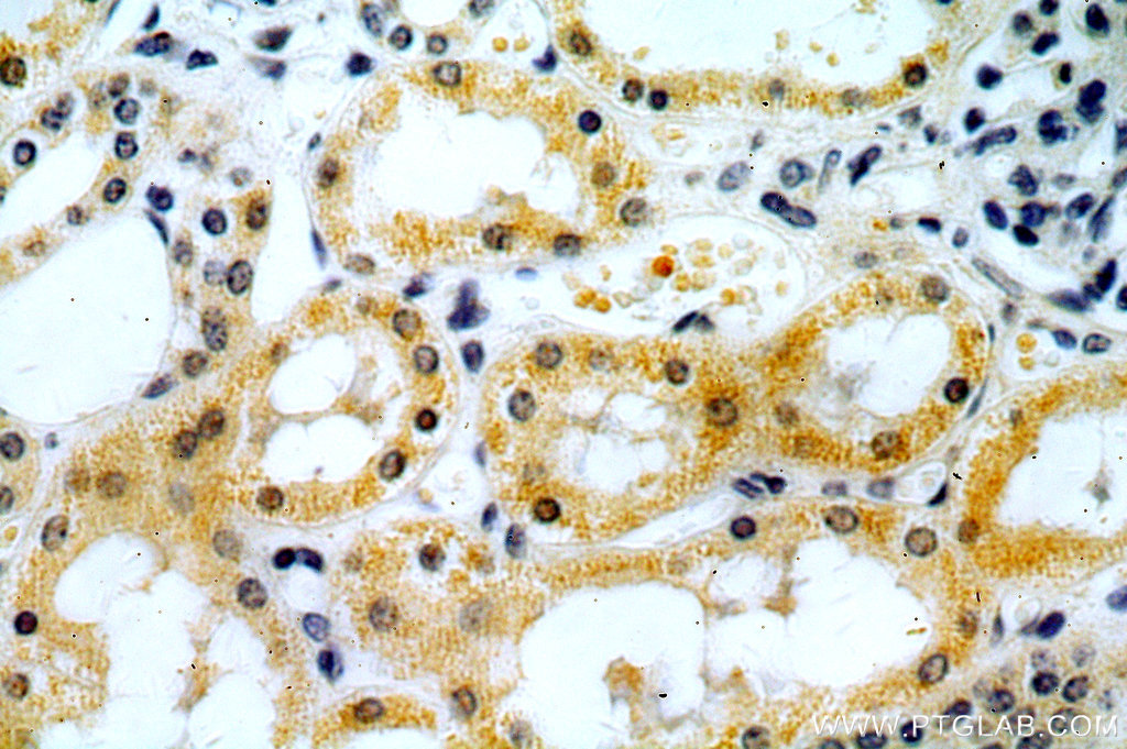 IHC staining of human kidney using 18474-1-AP