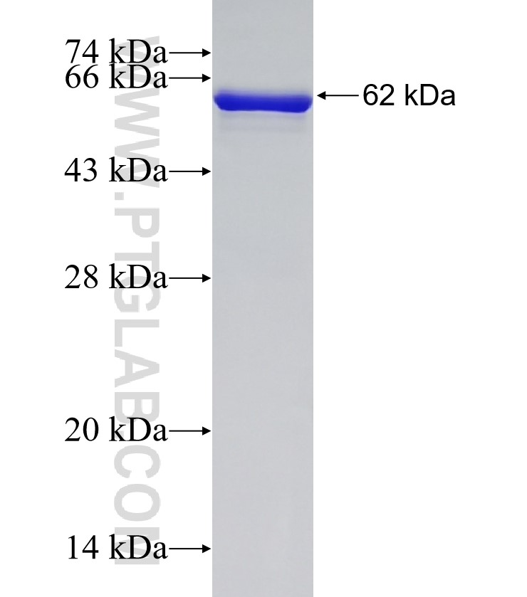 IKBKG fusion protein Ag13358 SDS-PAGE