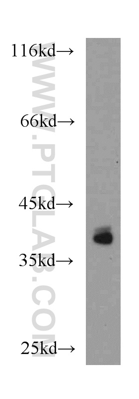 WB analysis of mouse skeletal muscle using 14589-1-AP