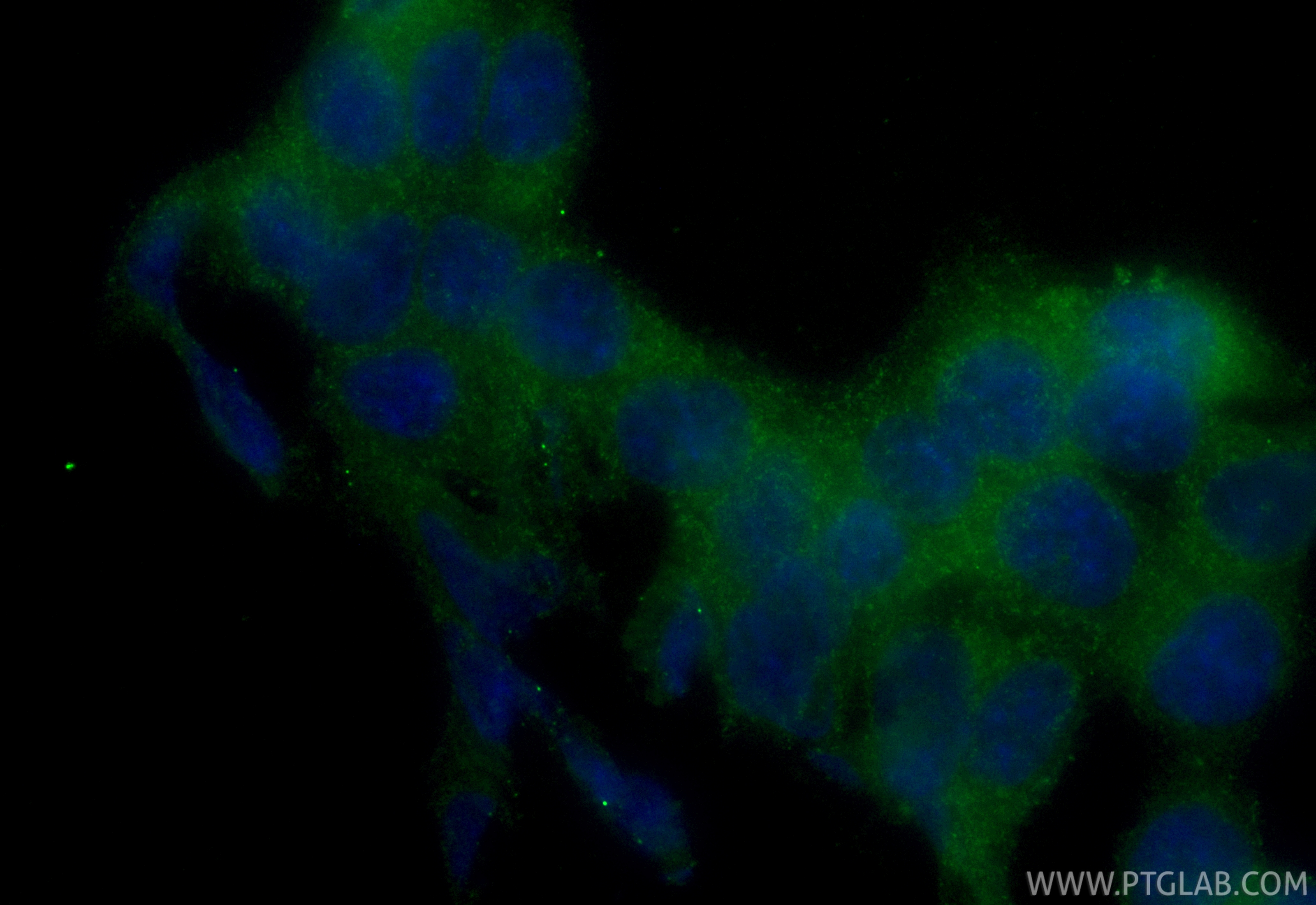 Immunofluorescent analysis of (4% PFA) fixed HCT 116 cells using CoraLite® Plus 488 IKKA antibody (CL488-84372-5, Clone: 241579D12 ) at dilution of 1:200. IF Staining of HCT 116 using CL488-84372-5