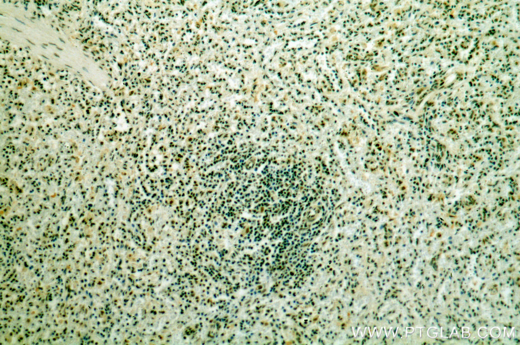 IHC staining of human spleen using 19055-1-AP (same clone as 19055-1-PBS)