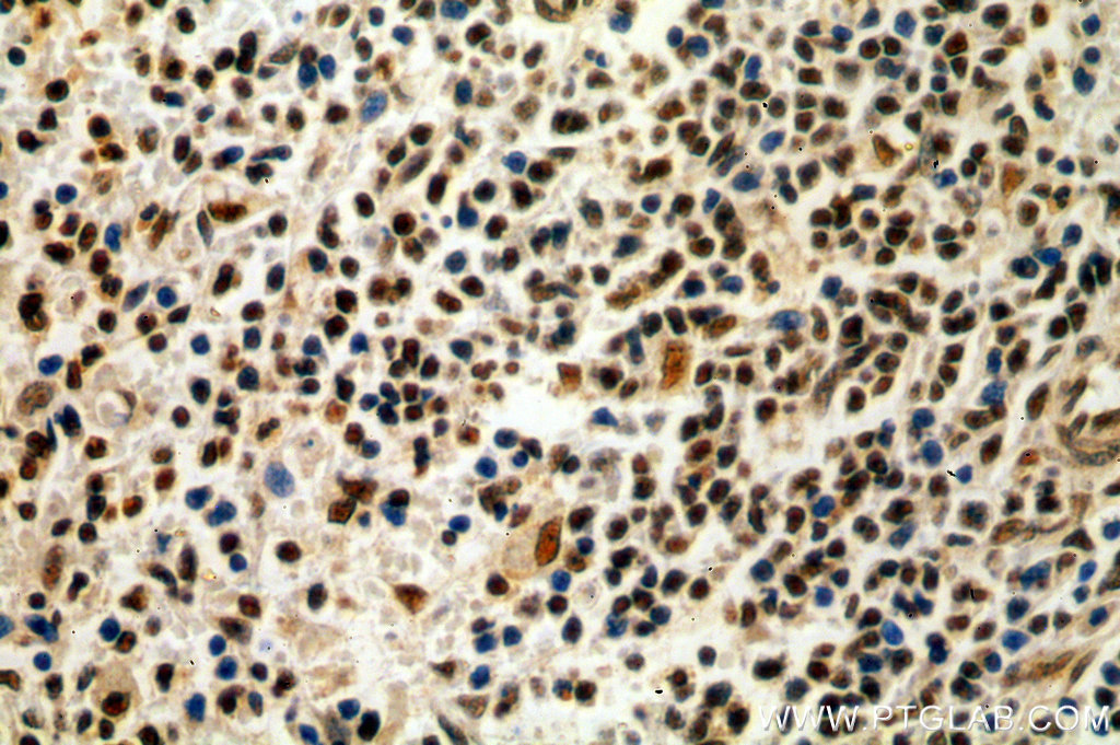 IHC staining of human spleen using 19055-1-AP (same clone as 19055-1-PBS)