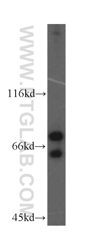 WB analysis of HepG2 using 19055-1-AP (same clone as 19055-1-PBS)