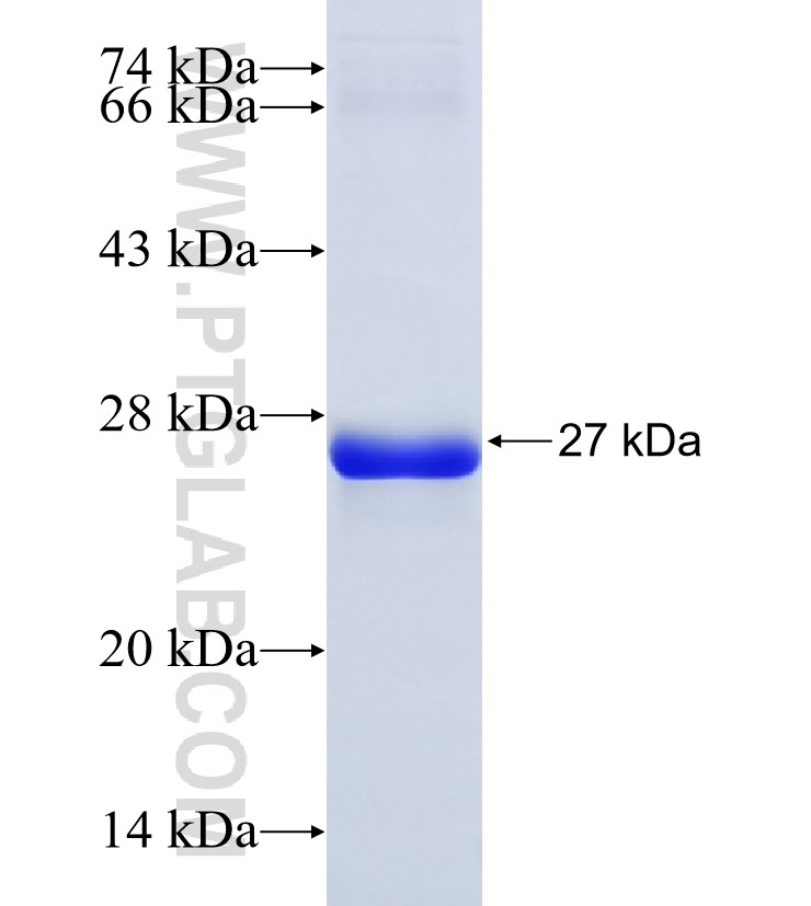 IKZF4 fusion protein Ag34792 SDS-PAGE IKZF4 fusion protein Ag34792 SDS-PAGE
