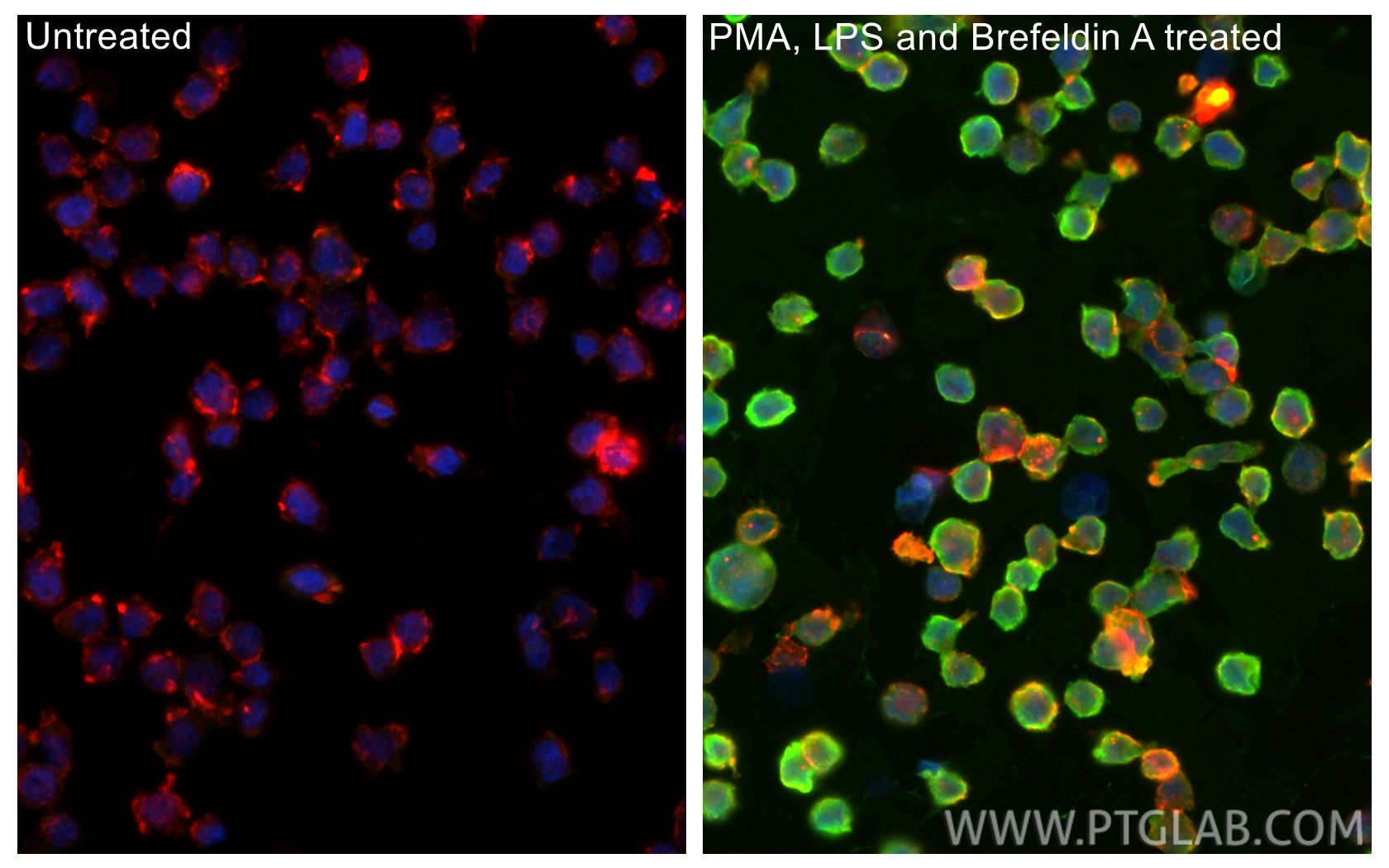 Immunofluorescent analysis of (4% PFA) fixed PMA, LPS and Brefeldin A treated THP-1 cells using IL-1 beta antibody (RMX00024) at dilution of 1:400 and CoraLite®488-Conjugated Goat Anti-Rabbit IgG(H+L) (<a class='green' href='/productredirect?CatalogNo=SA00013-2' target='_blank'>SA00013-2</a>), CL594-phalloidin (red). IF Staining of THP-1 using RMX00024