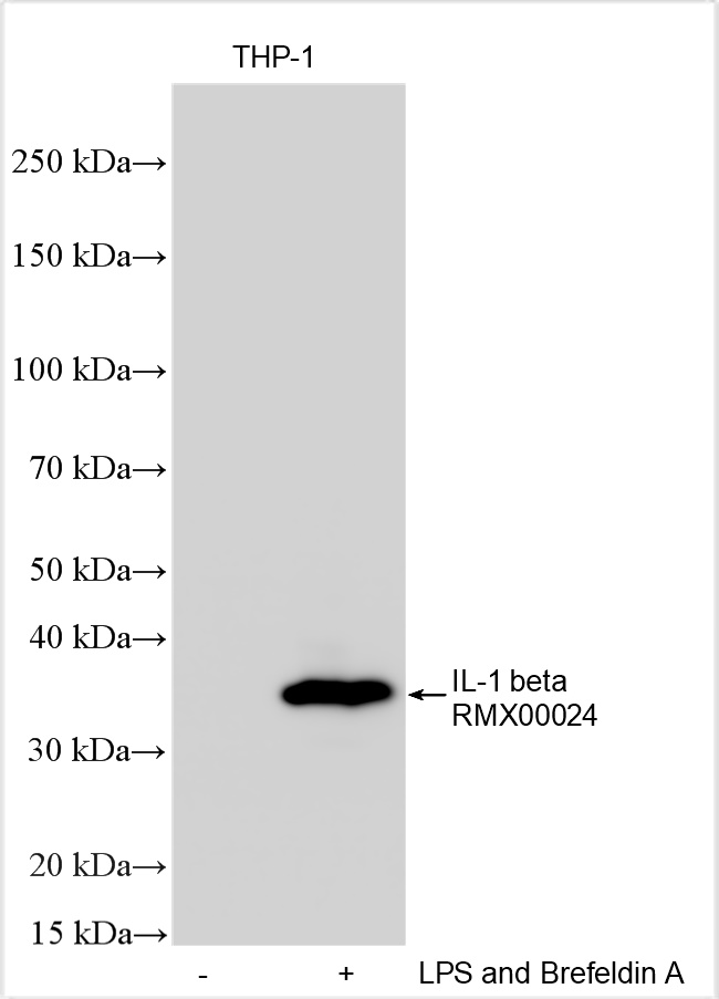 WB analysis using RMX00024