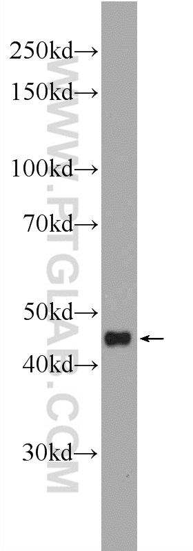 WB analysis of Recombinant protein using 20850-1-AP