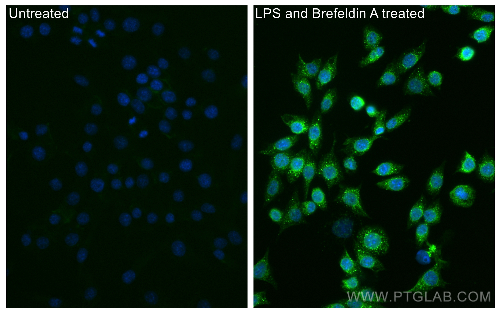 IF Staining of RAW 264.7 using CL488-82191-3