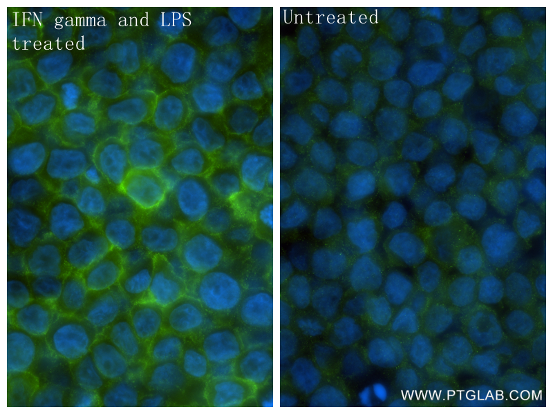 IF Staining of THP-1 using 85754-4-RR