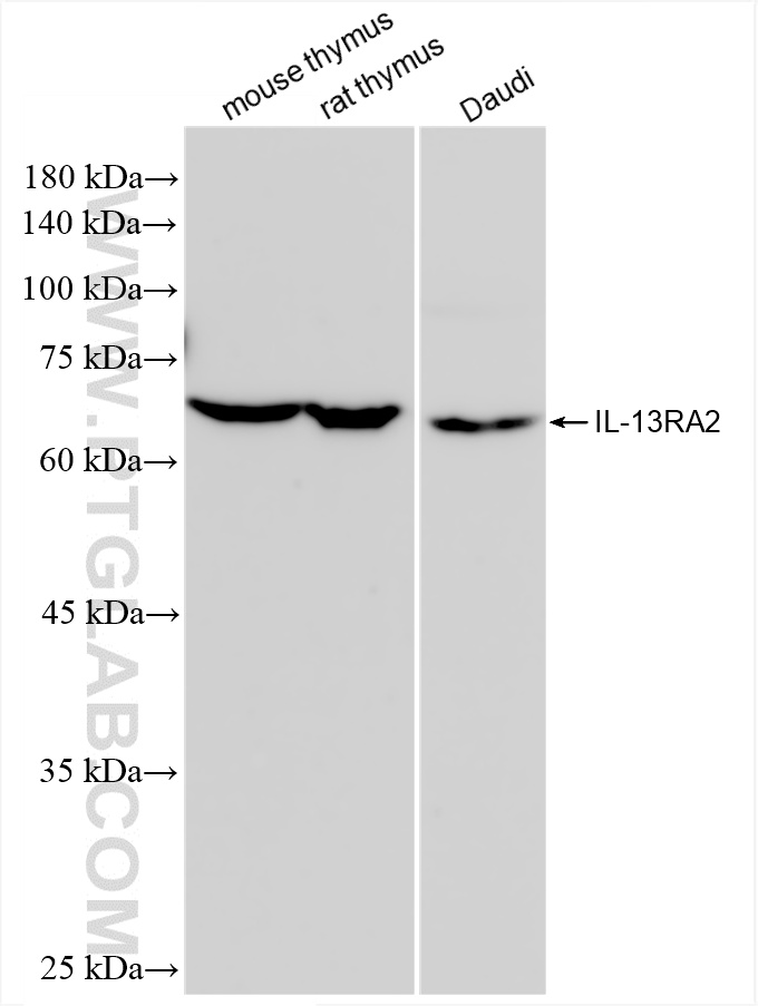 WB analysis using 85631-1-RR