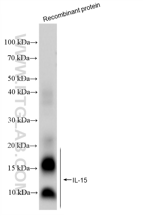WB analysis of Recombinant protein using 84512-4-RR (same clone as 84512-4-PBS) WB analysis of Recombinant protein using 84512-4-RR (same clone as 84512-4-PBS)