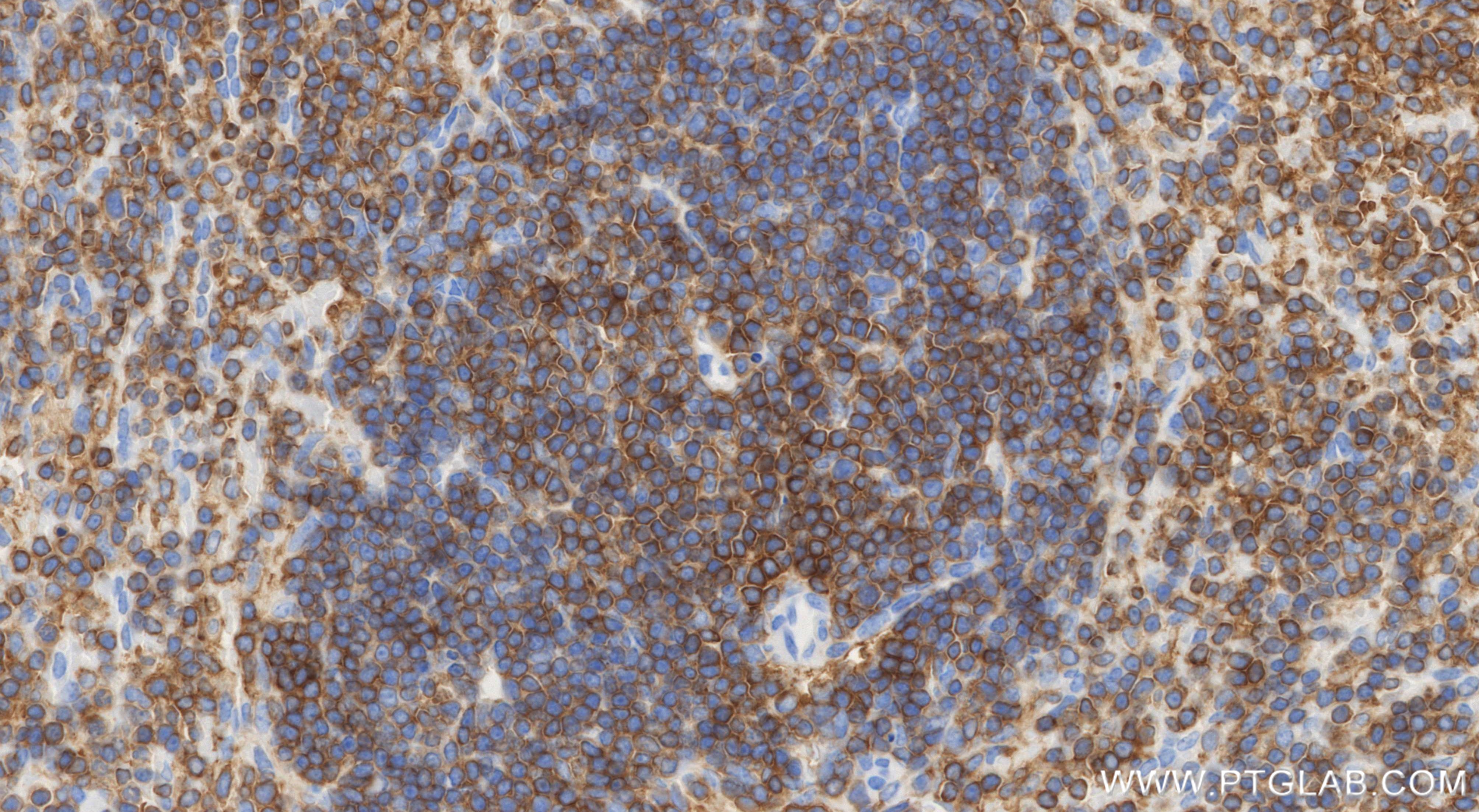 IHC staining of mouse spleen using 86421-1-RR