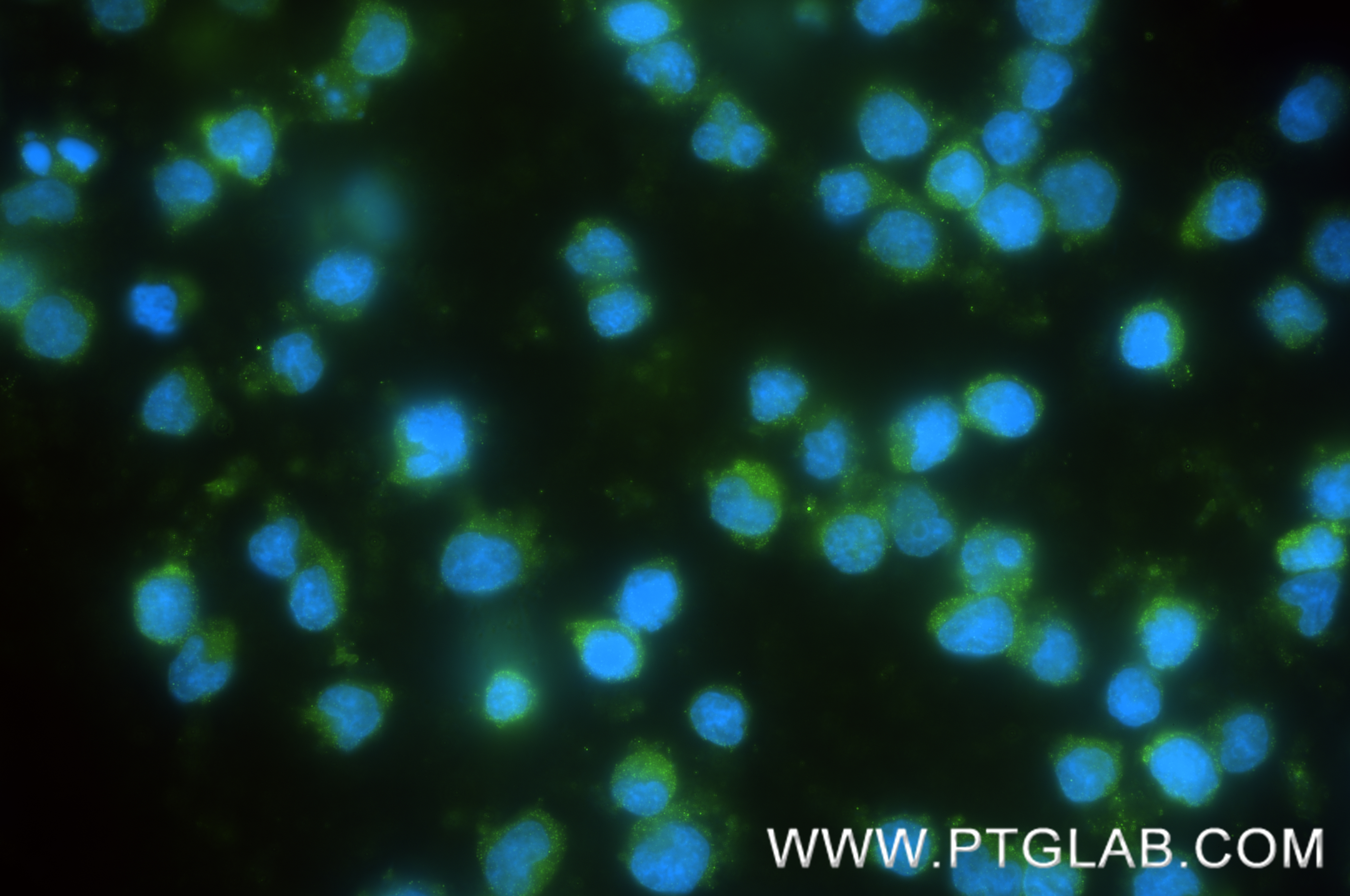 IF Staining of Jurkat using 86927-2-RR (same clone as 86927-2-PBS)