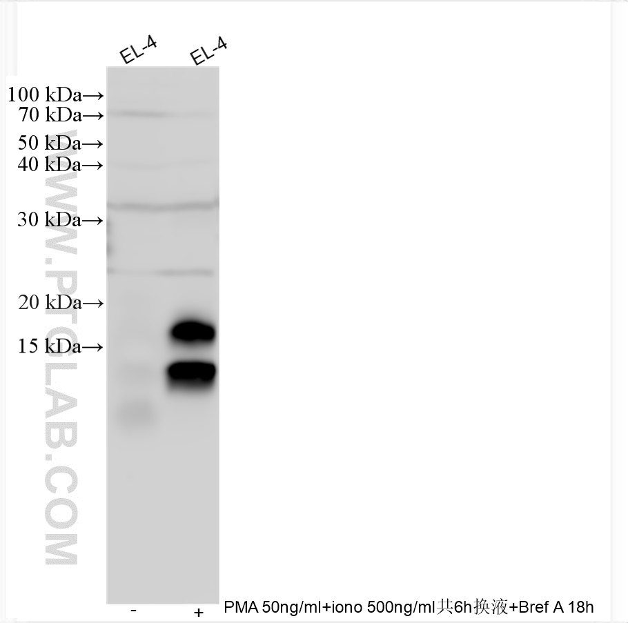 WB analysis using 30754-1-AP