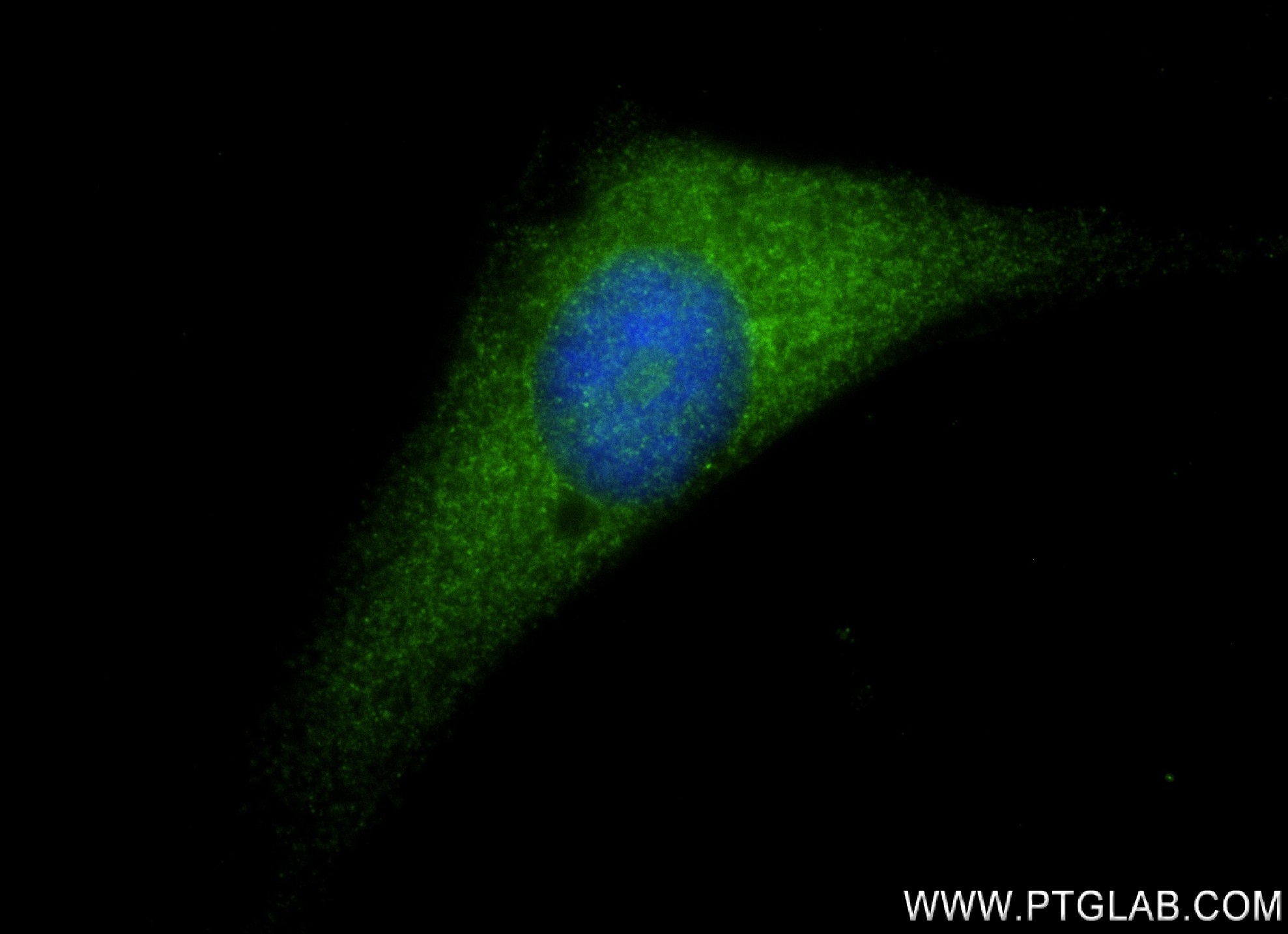 IF Staining of HeLa using 82907-1-RR (same clone as 82907-1-PBS)