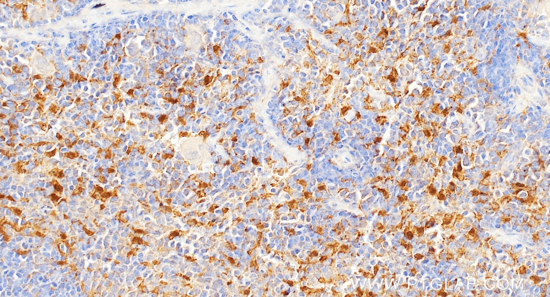 IHC staining of mouse spleen using 87348-2-RR IHC staining of mouse spleen using 87348-2-RR
