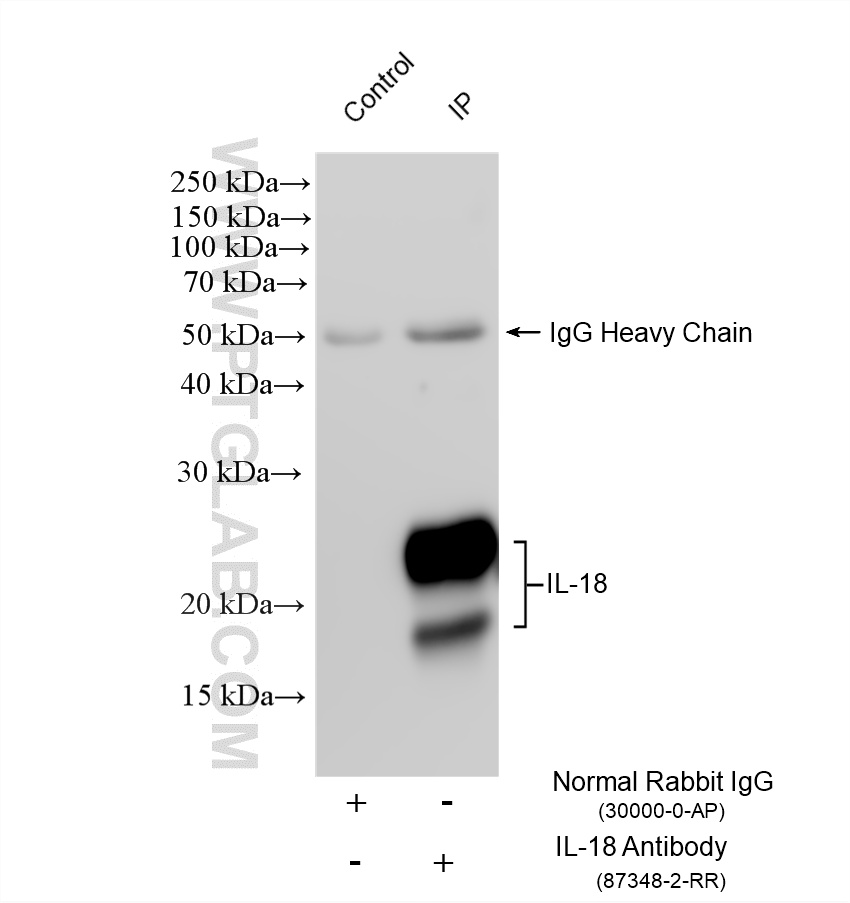 IP experiment of mouse spleen using 87348-2-RR IP experiment of mouse spleen using 87348-2-RR