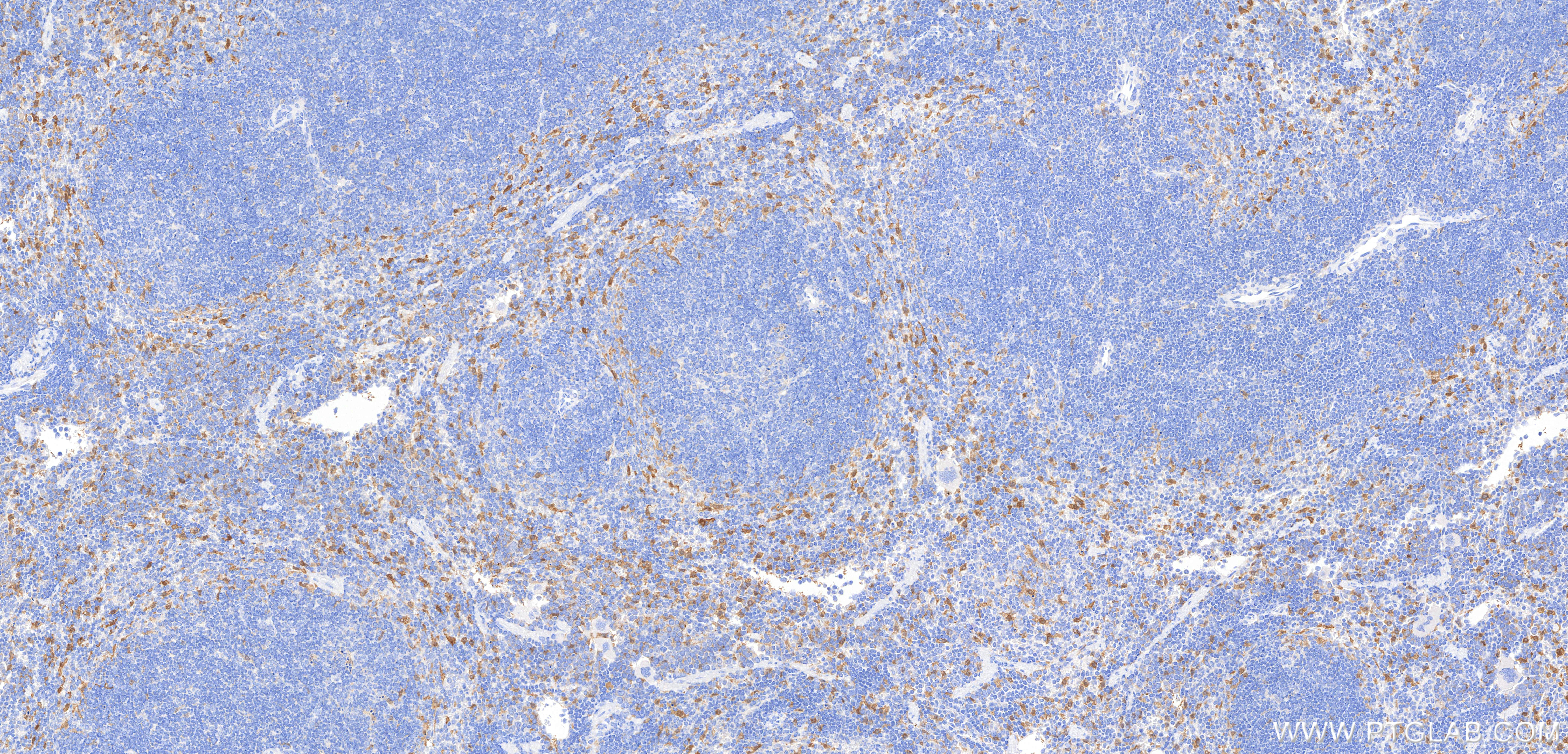 IHC staining of mouse spleen using 98846-3-RR IHC staining of mouse spleen using 98846-3-RR