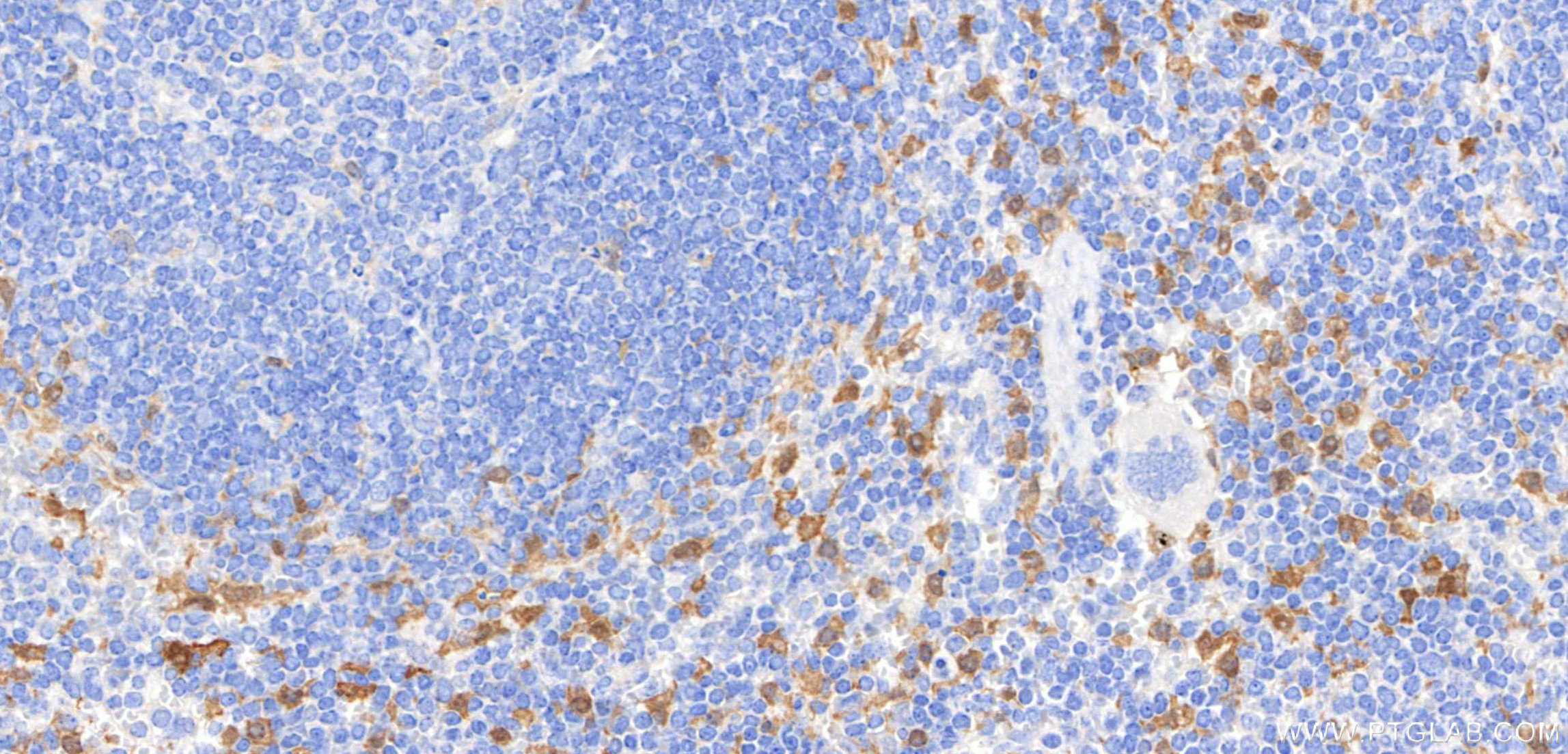 IHC staining of mouse spleen using 98846-3-RR IHC staining of mouse spleen using 98846-3-RR